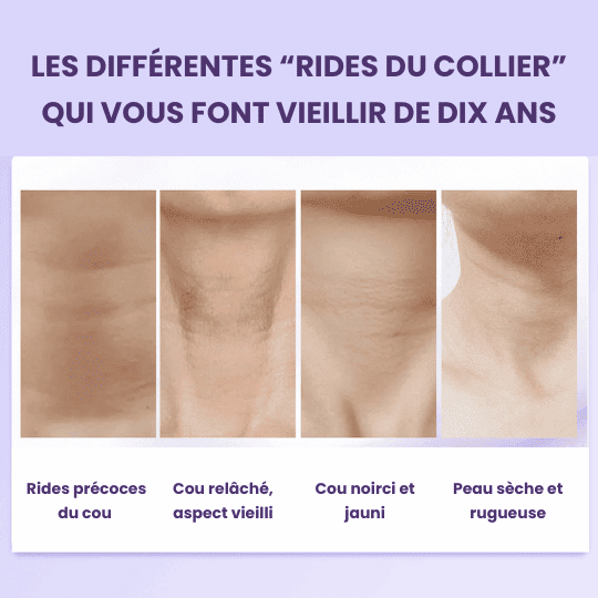 EELHOE - Baume raffermissant nourrissant, cible les rides et le relâchement cutané du cou