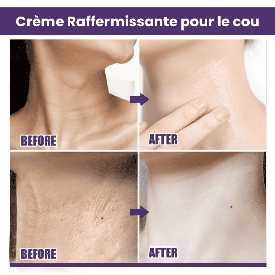 EELHOE - Baume raffermissant nourrissant, cible les rides et le relâchement cutané du cou